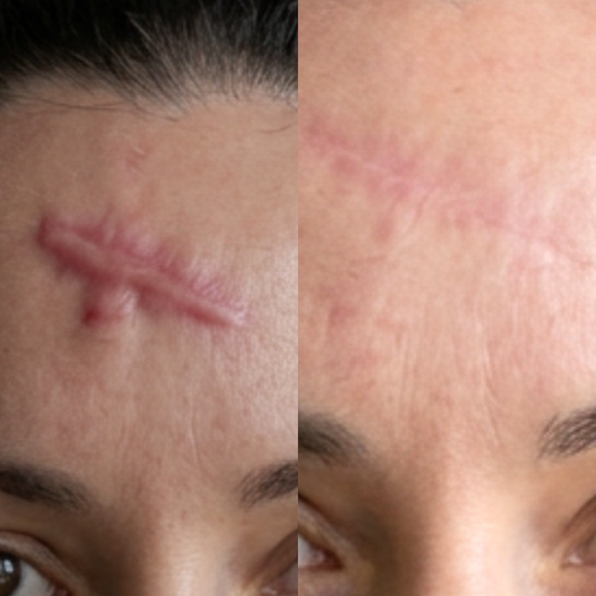 After — Day 30