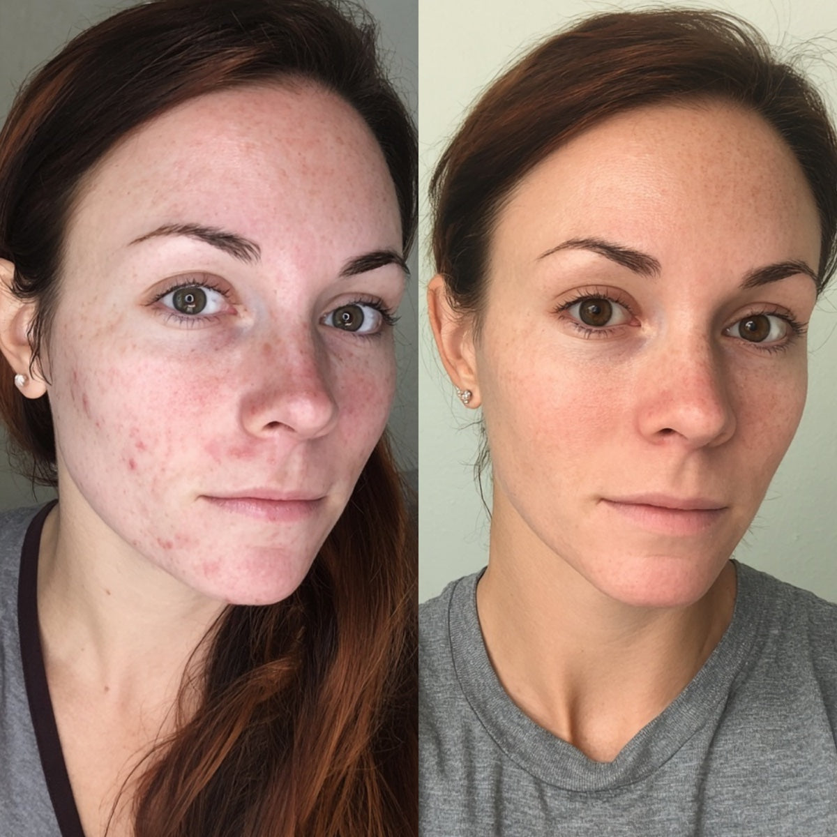After — Day 30