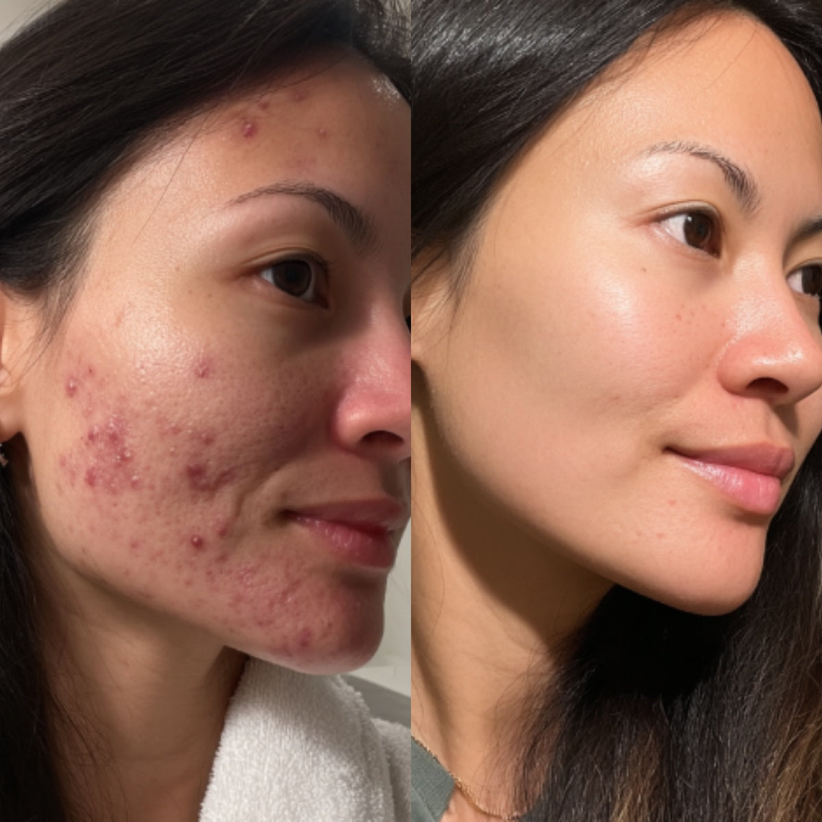 After — Day 30