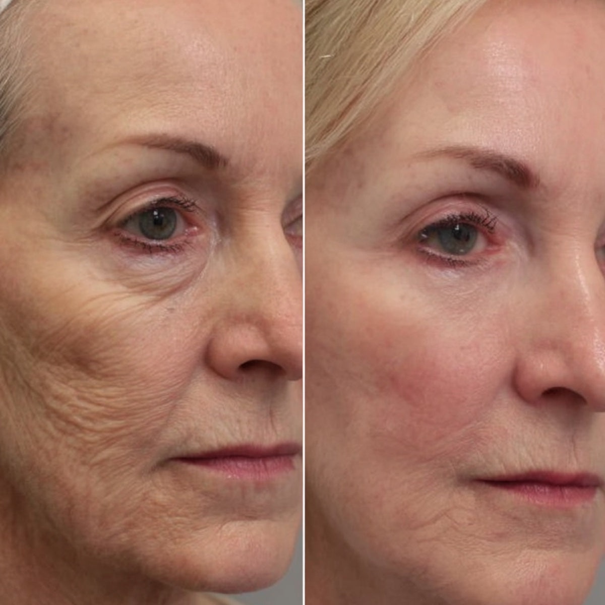 After — Day 30