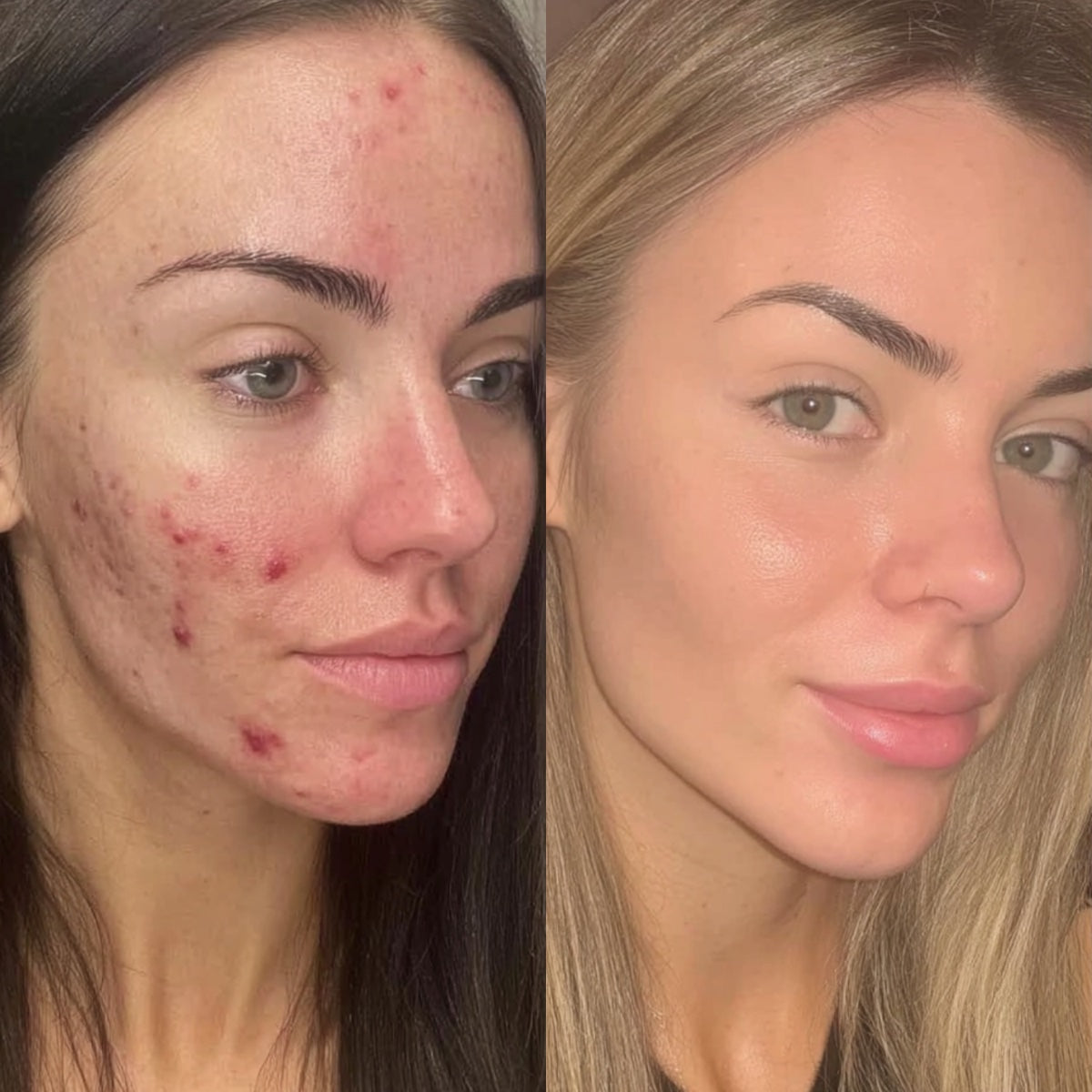 After — Day 30