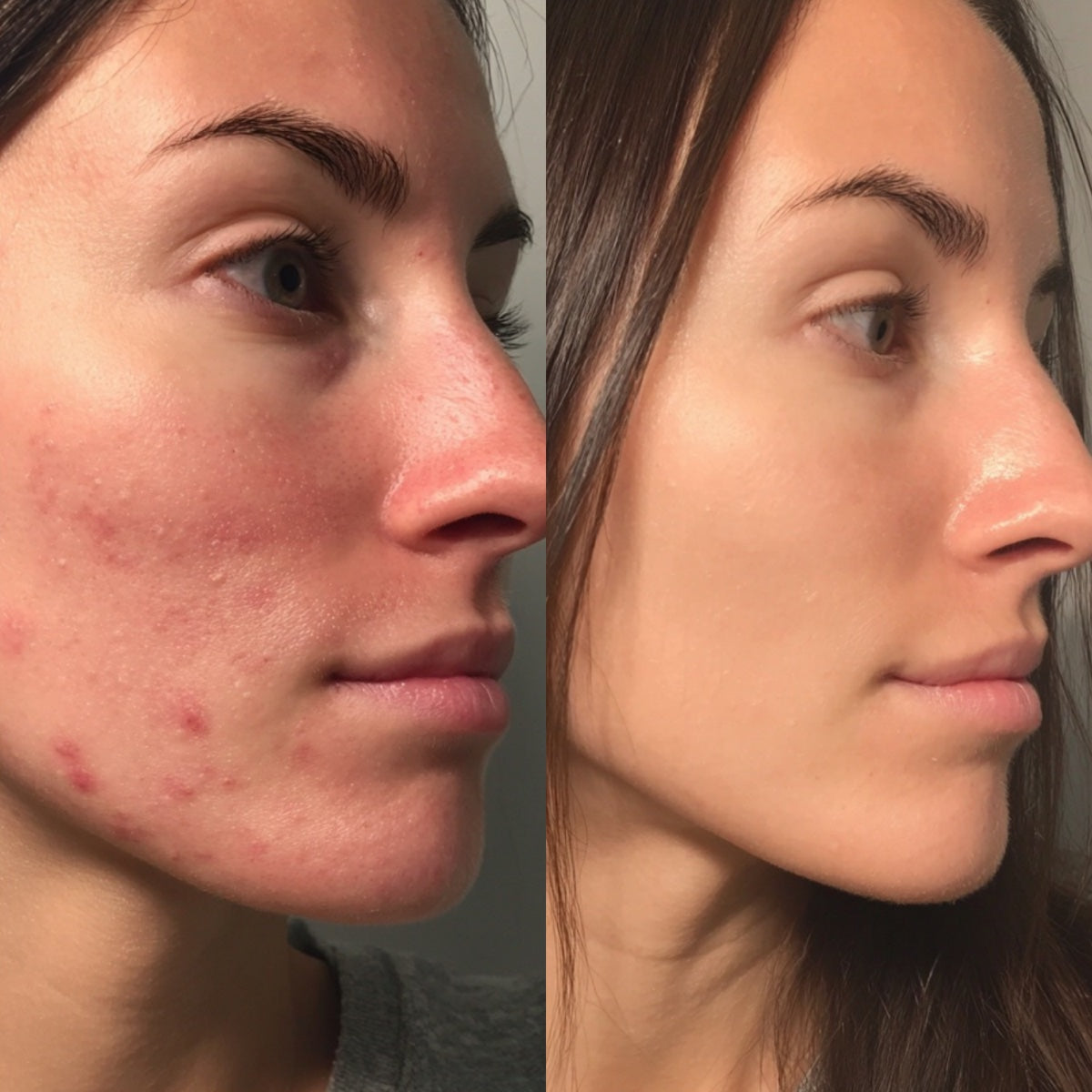 After — Day 30