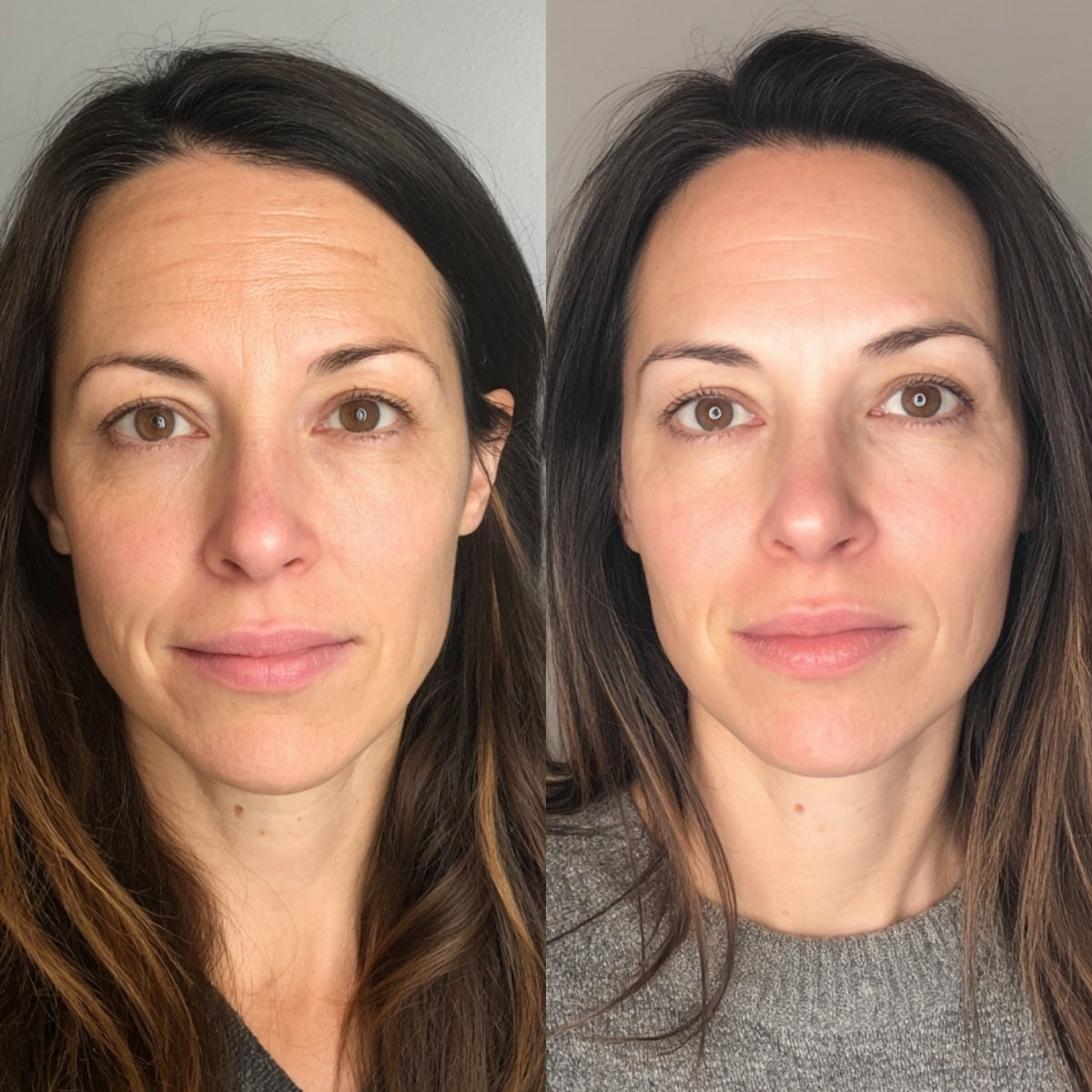 After — Day 30